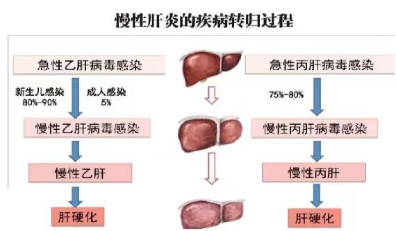 【健康科普】世界肝炎日——堅持早預(yù)防,加強(qiáng)檢測發(fā)現(xiàn),規(guī)范抗病毒治療